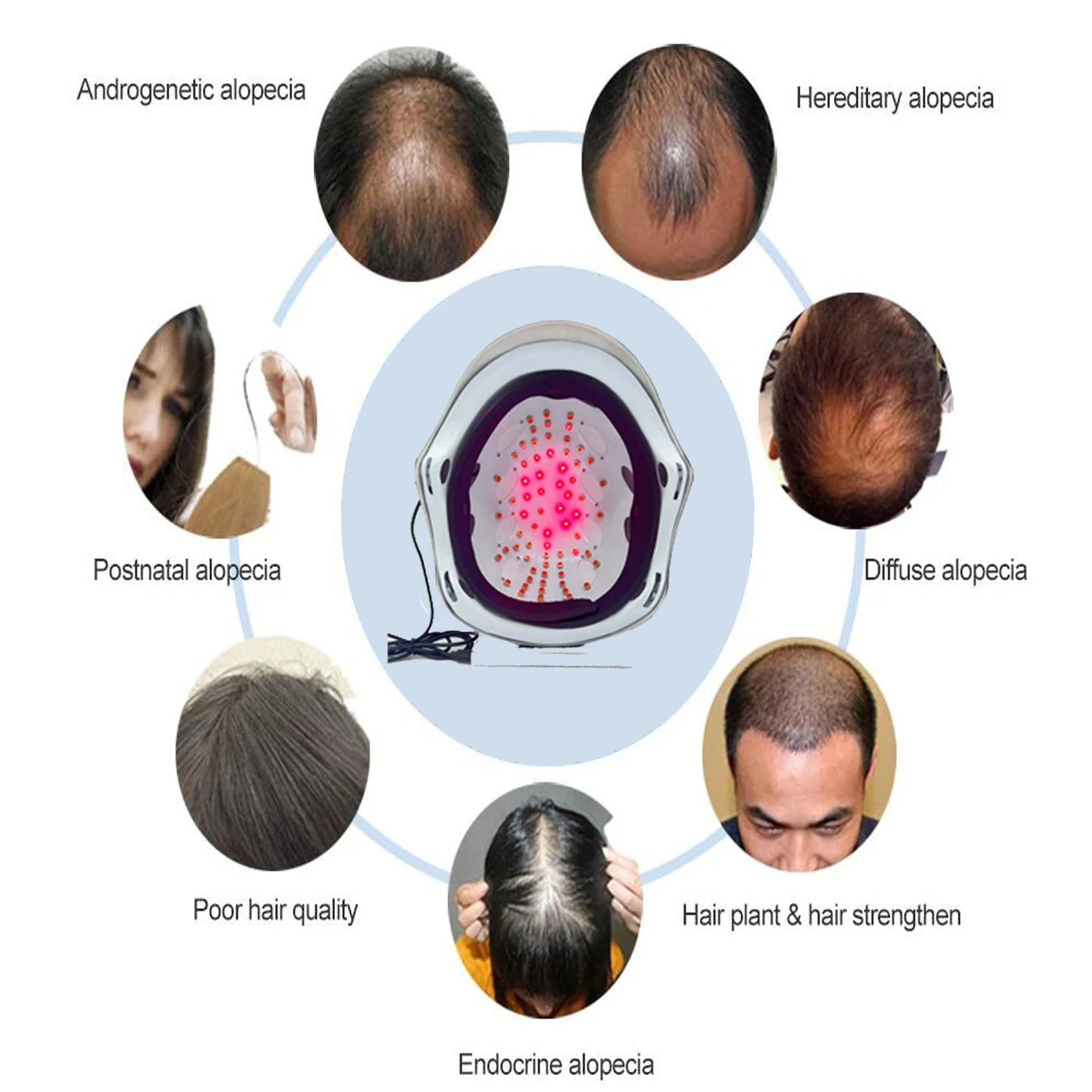 Hair Growth Cap Anti Hair Loss Hair Growth Laser Helmet Hat Hair Regrowth Light Therapy Device Hair Growth Treatment Hat Machine